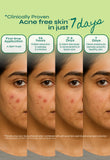 Tikitoro Teens Anti-Acne Gel Moisturizer