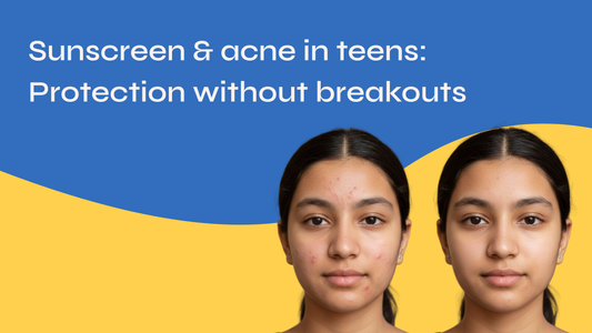 Sunscreen & Acne in Teens: Protection Without Breakouts