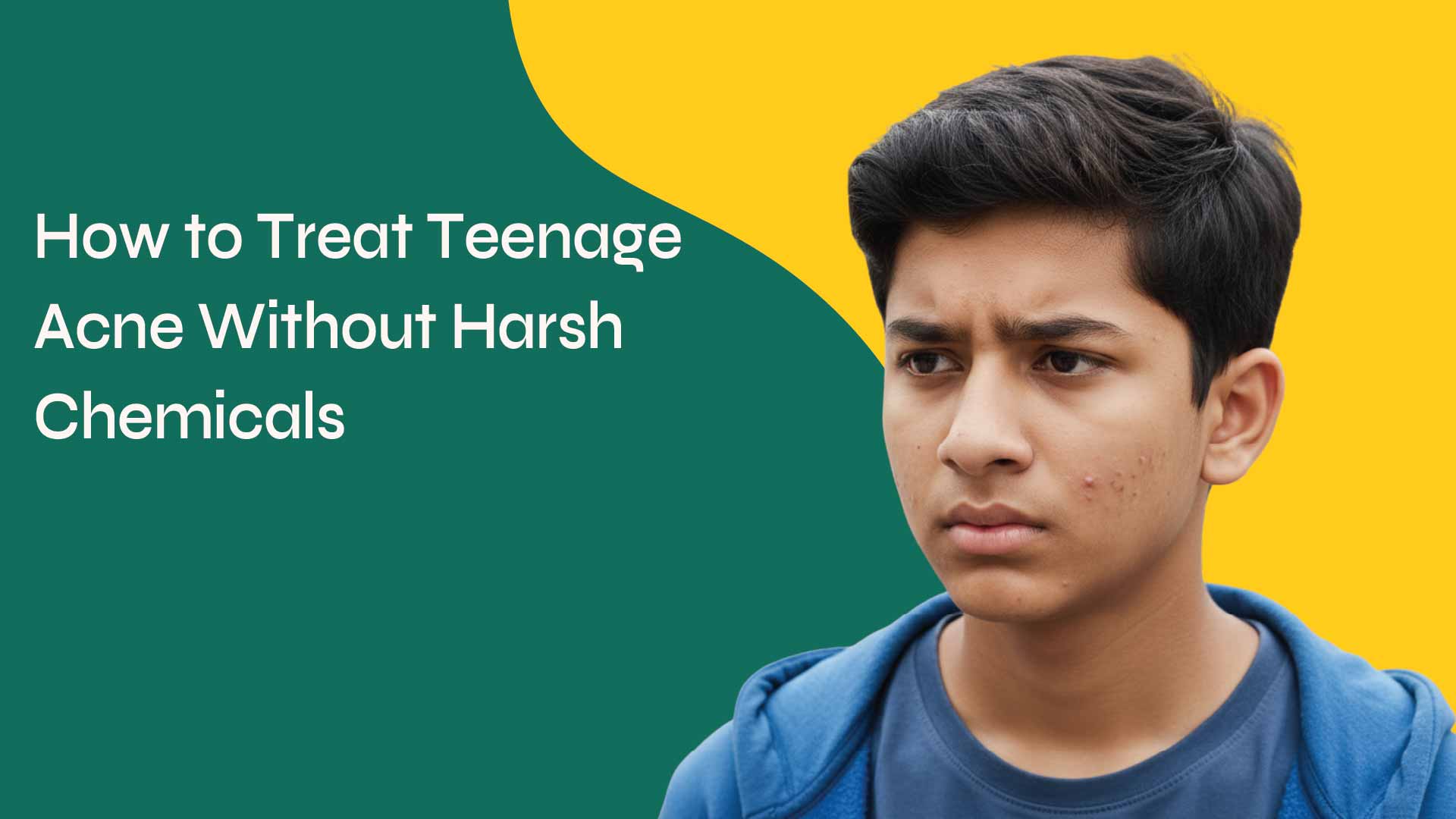 How to Treat Teenage Acne Without Harsh Chemicals