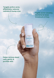 Tikitoro Teens Anti - Acne Care Kit - Tikitoro