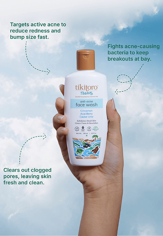 Tikitoro Teens Anti - Acne Face wash - Tikitoro