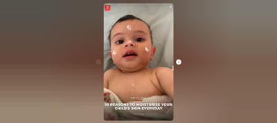 10 Reasons To Moisturise Your Child's Skin Everyday